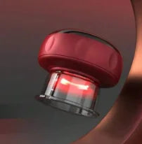 Lorvane™ Smart Cupping Device  Still dealing with tight, sore, tense muscles?